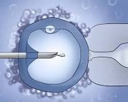 ICSI (intrasitoplazmik sperm enjeksiyonu) resmi